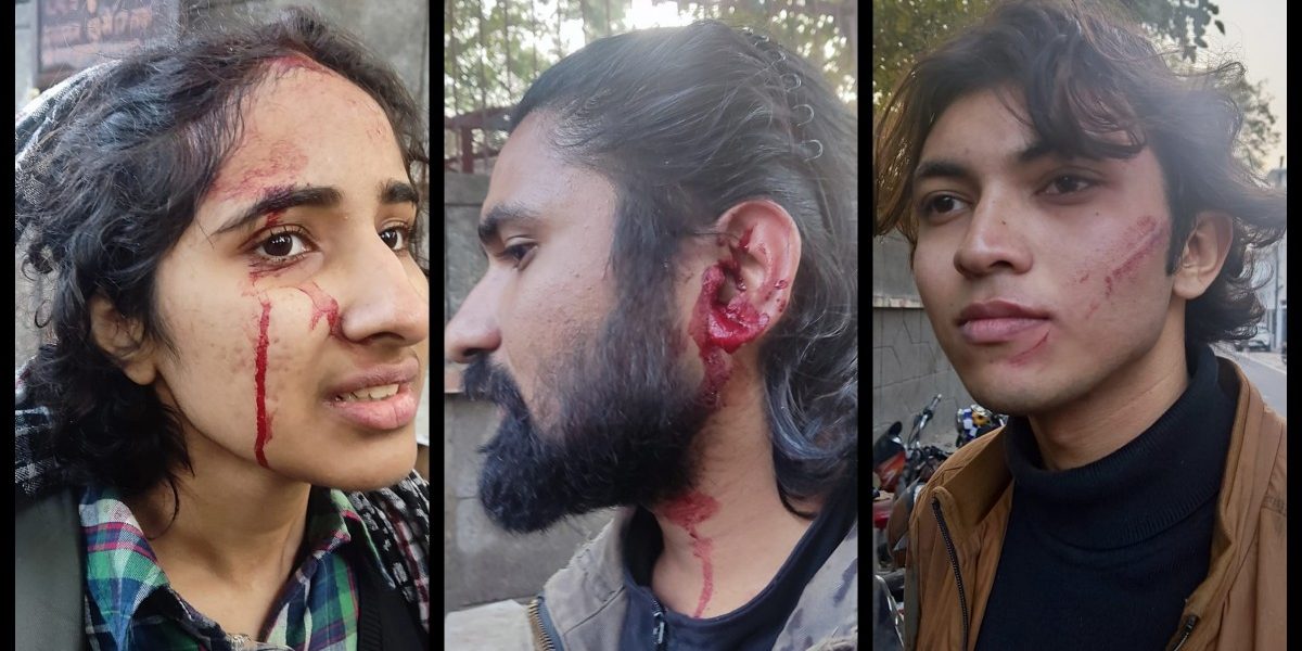 زخمی مظاہرین۔ (تصویر: اسپیشل ارینجمنٹ)